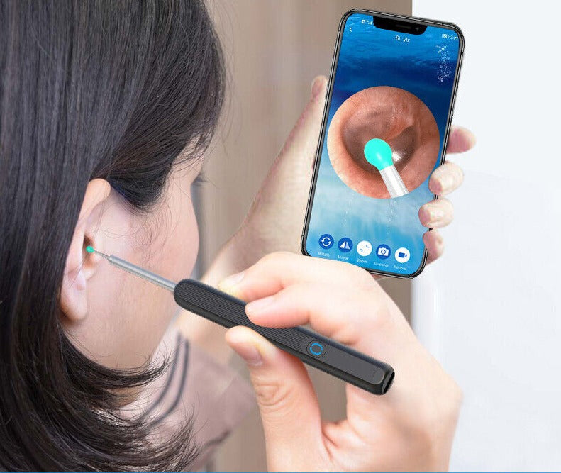 Smart Ear Wax Cleaner