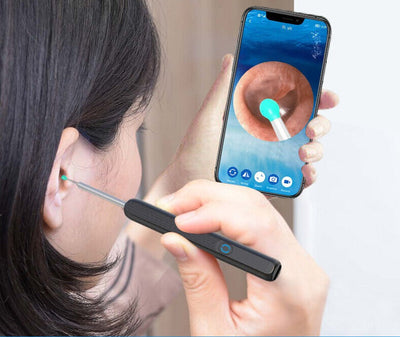 Smart Ear Wax Cleaner
